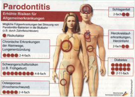 Parodontitis und Allgemeinerkrankungen ©Chlorhexamed/Dt. Infografikdienst